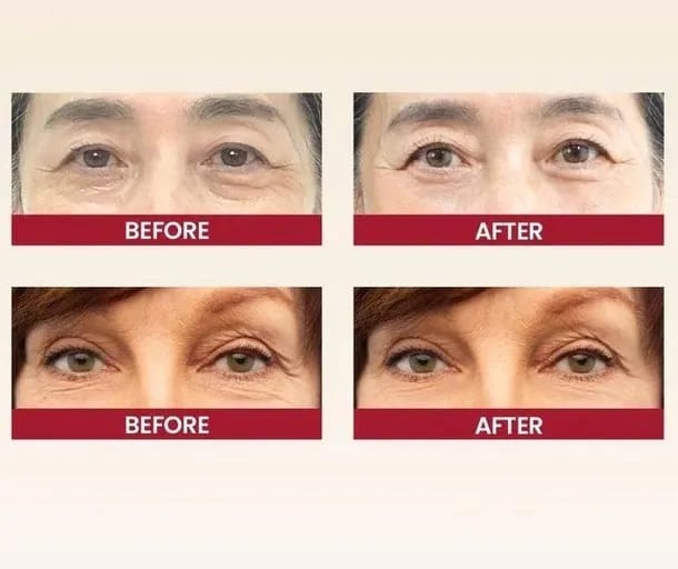 Eye Cream for Wrinkles & Dark Circles