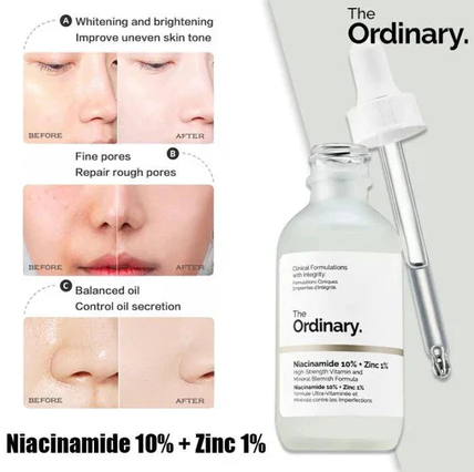 Niacinamide Serum  for Acne Marks & Bright Skin