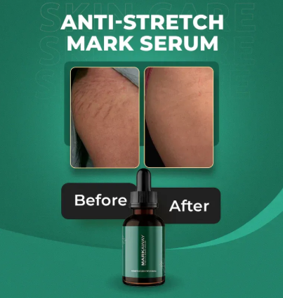 Stretch Mark Serum Herbal Formula for Scars & Skin Elasticity