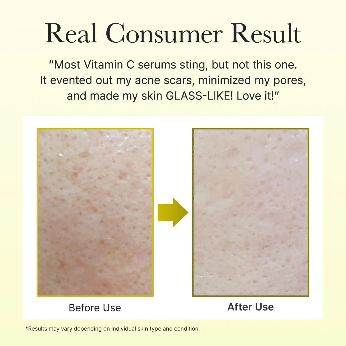 Vitamin C Booster Shot |  Skin Radiance Serum